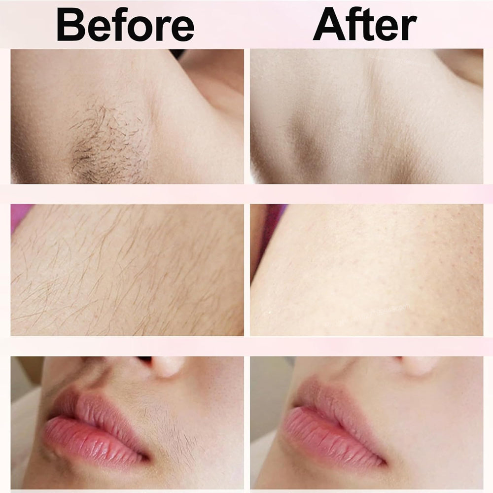 ZEZOURA Shaver™